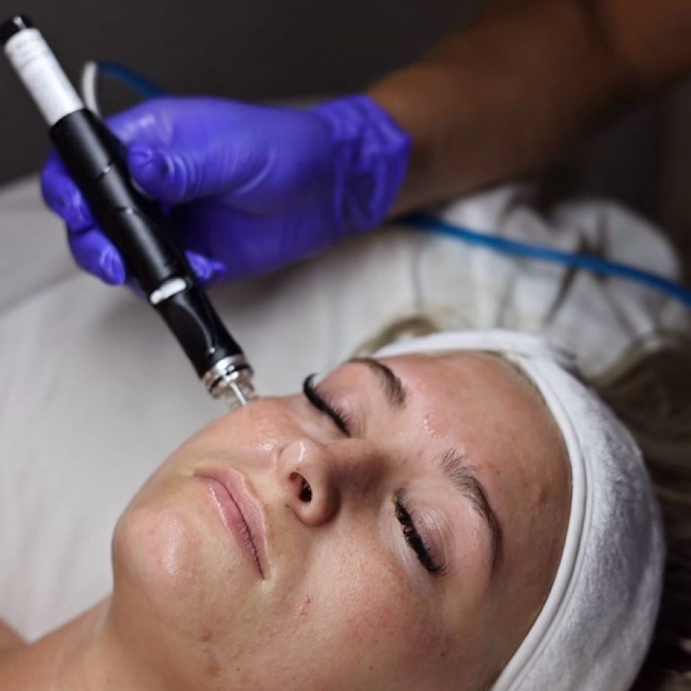Signature Hydrafacial at Align Massage & Bodywork in Salem, OH