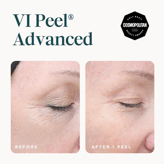 VI Peel Advanced