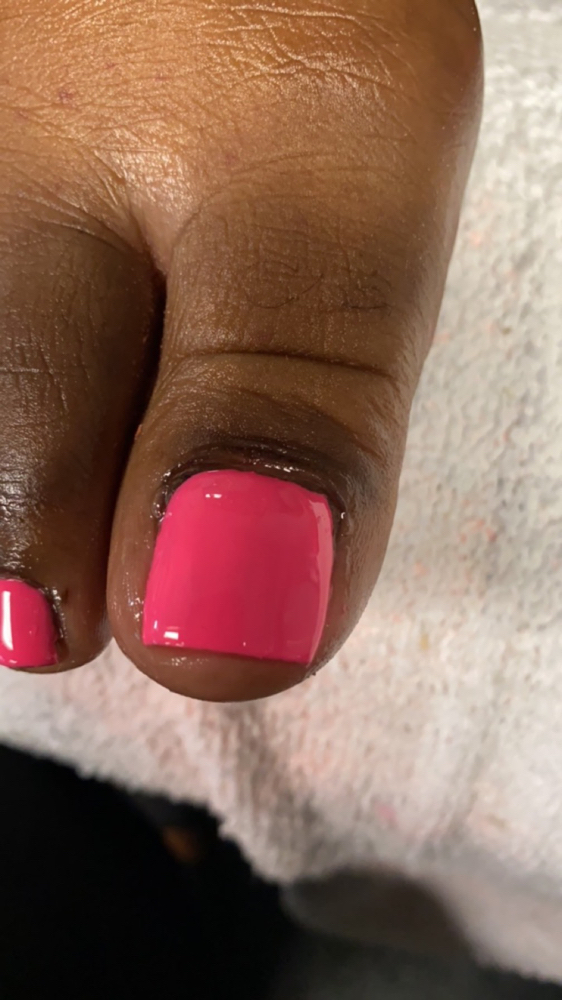 Acrylic Big Toe 2 '