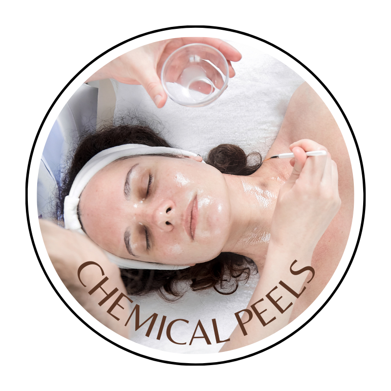 **60 MIN CHEMICAL PEEL(MEDIUM)