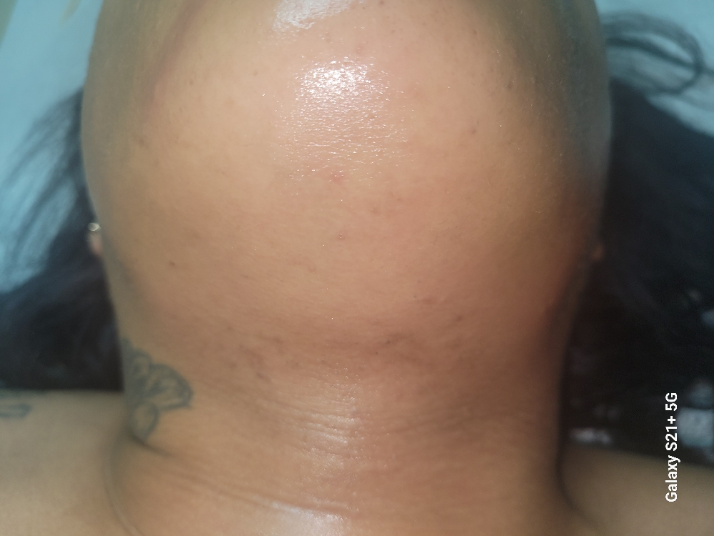Upper Lip And Chin Wax