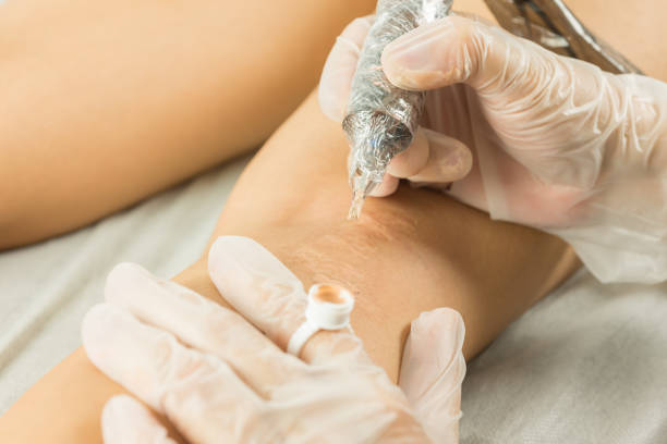 Paramedical Scar Camouflage at Inked & Nailed PMU and Restorative Esthetics in Burlington, NC