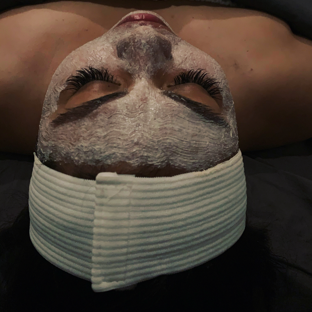 Microneedling