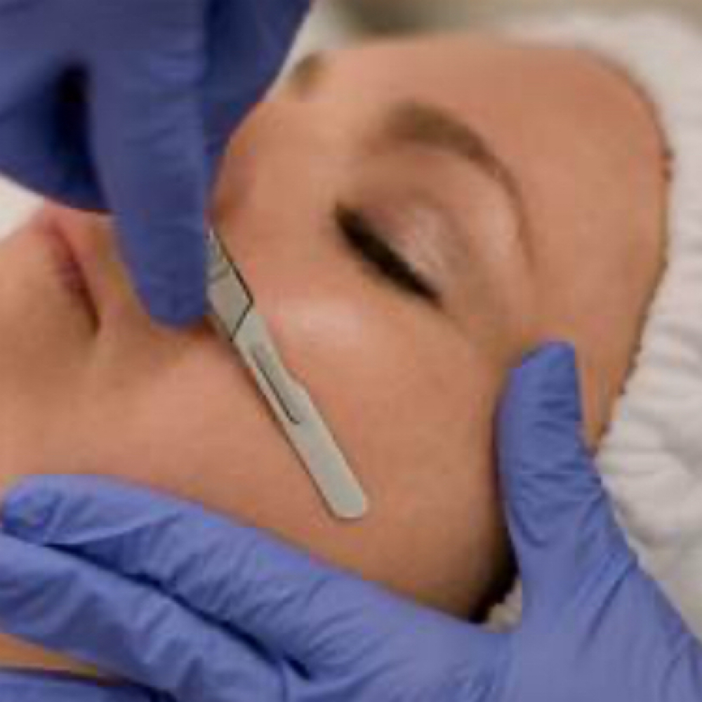 Epidermal Resurfacing at Janice Nicole Aesthetics in Albuquerque, NM