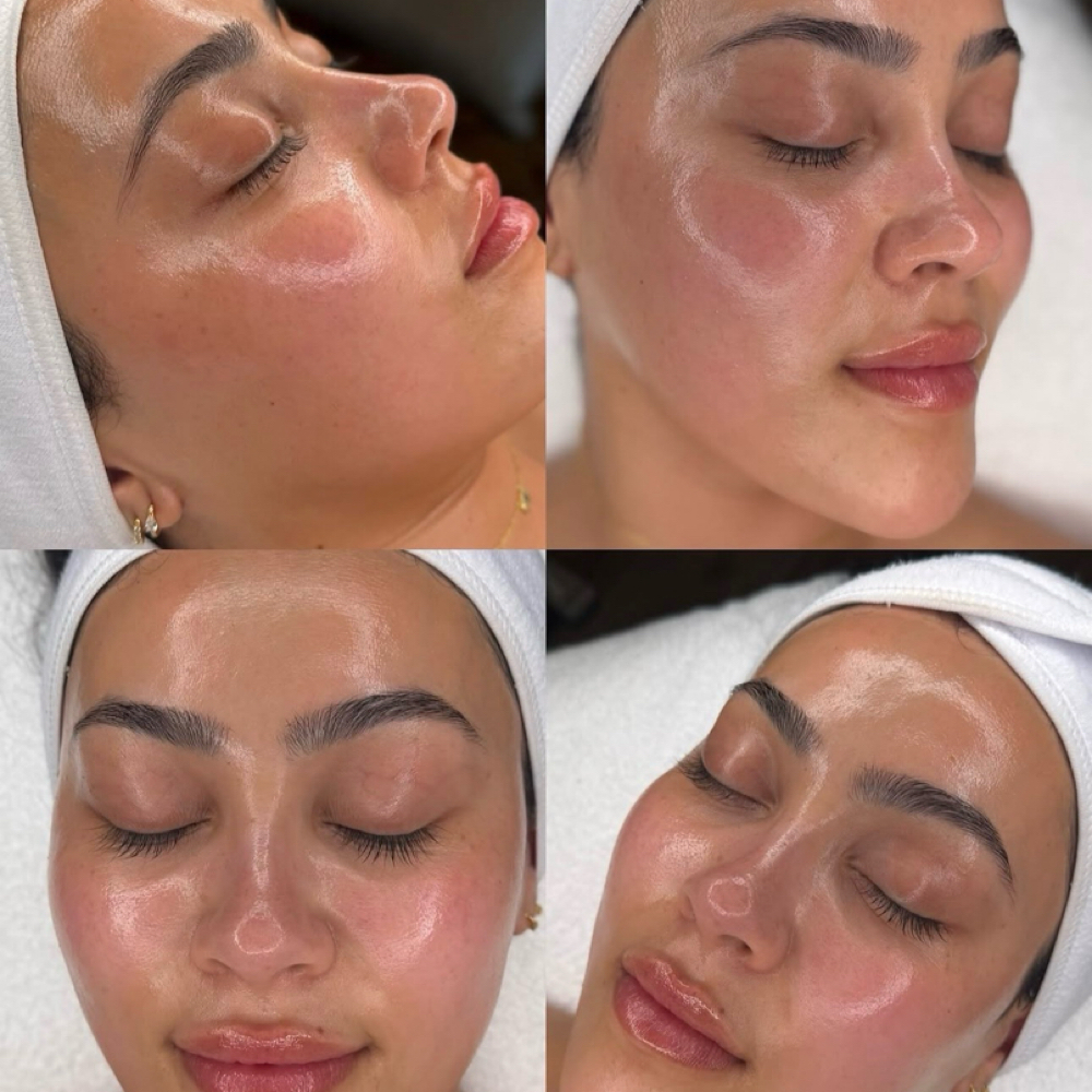 Hydra Facial MicroAbrasion at Amethyst Spa in Omaha, NE