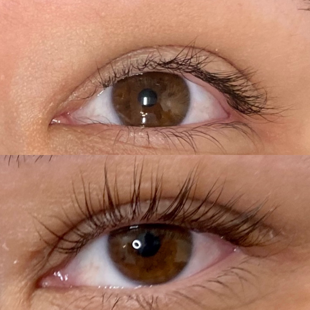 Eyelash Lift