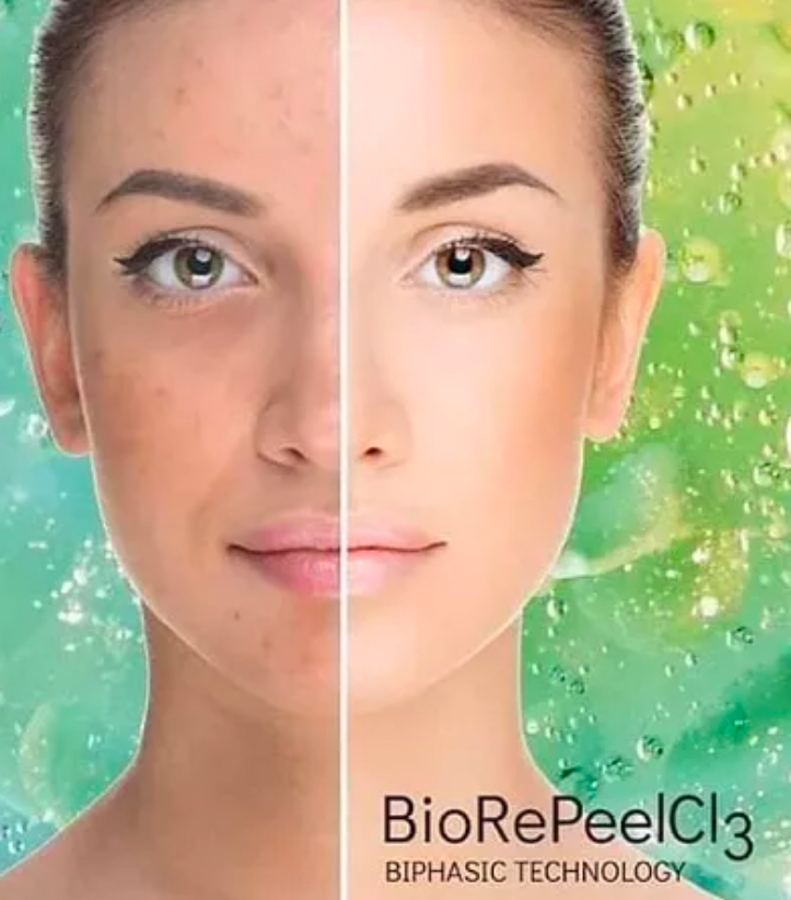 BioRePeel  - Peel Only