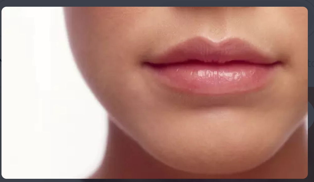 Lip Or Chin - Laser Hair Removal