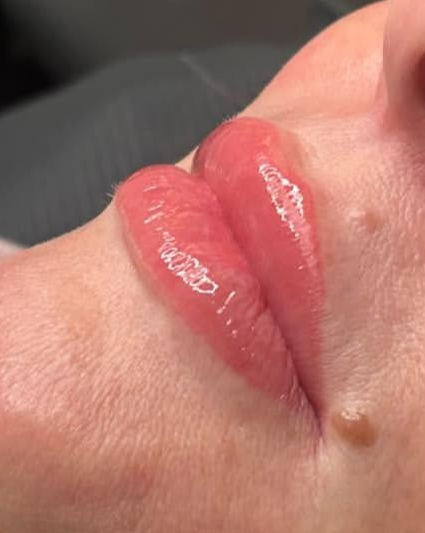 Lip blush
