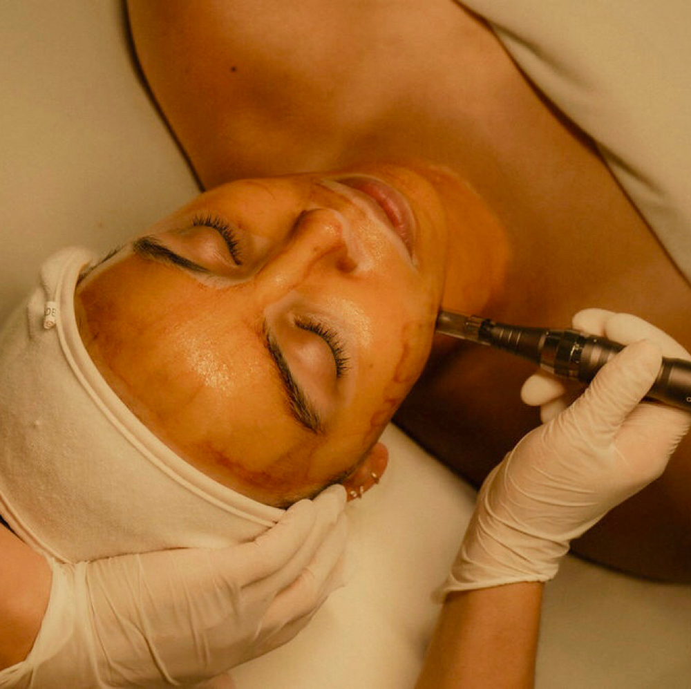Skin Infusion at McKenna Olivia Skin in Winter Park, FL