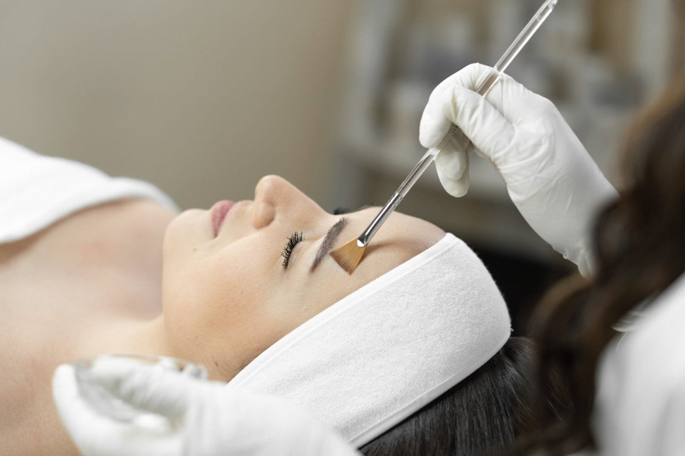 Chemical Peel