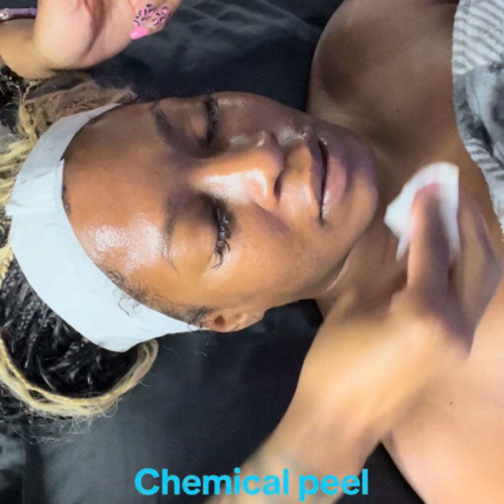 Orchid Glow Peel at SkinCare By Raven in Colorado Springs, CO