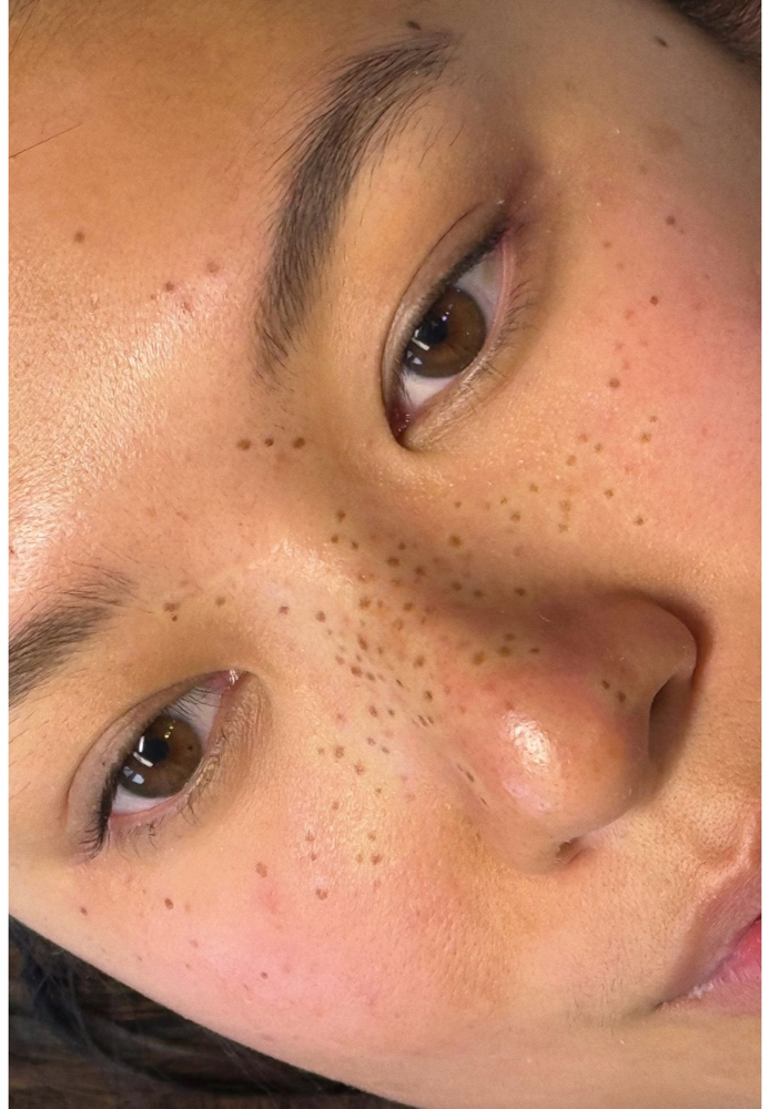 Permanent Freckles at Touched By TK in Charlotte, NC