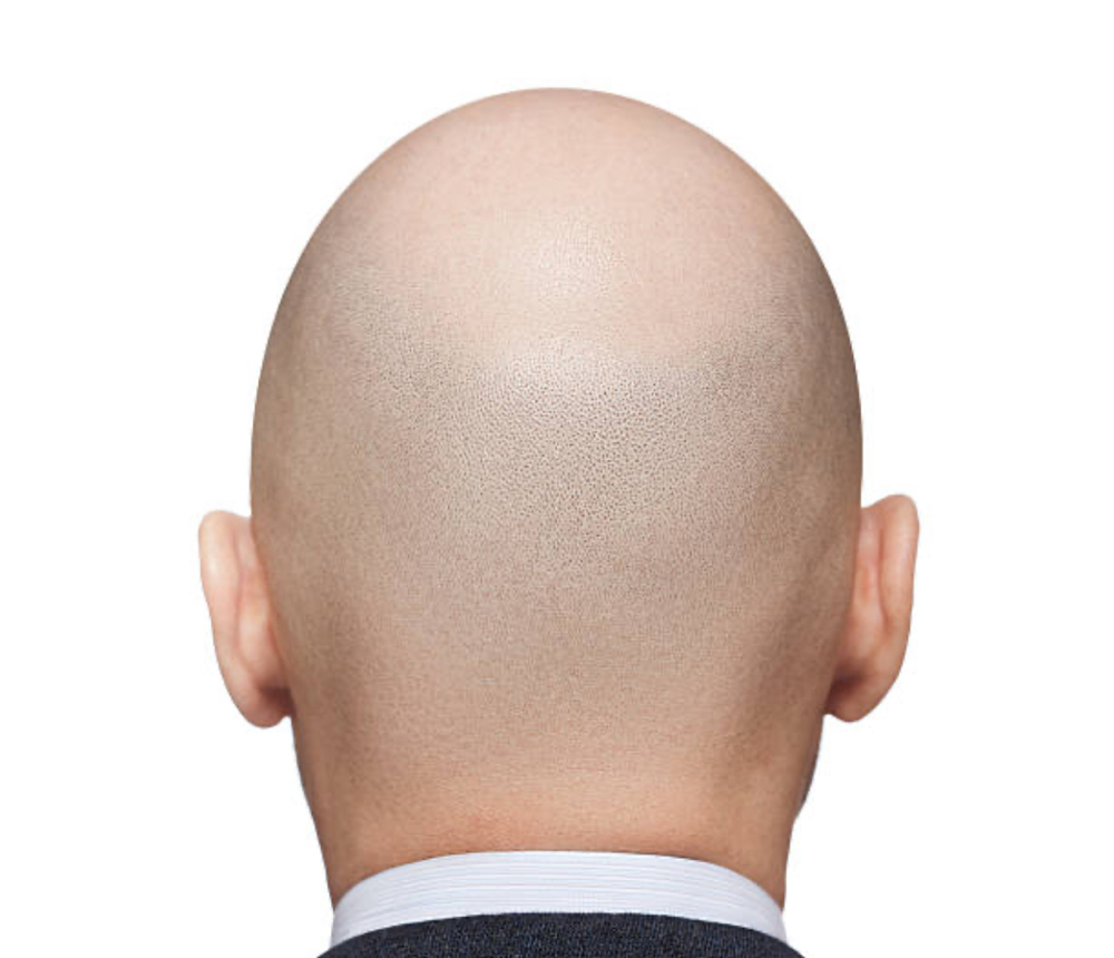 Bald Shave