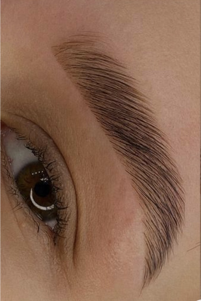 Brow Lamination