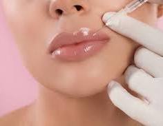 Lip Filler at Renu by Kellie in Harrison, AR