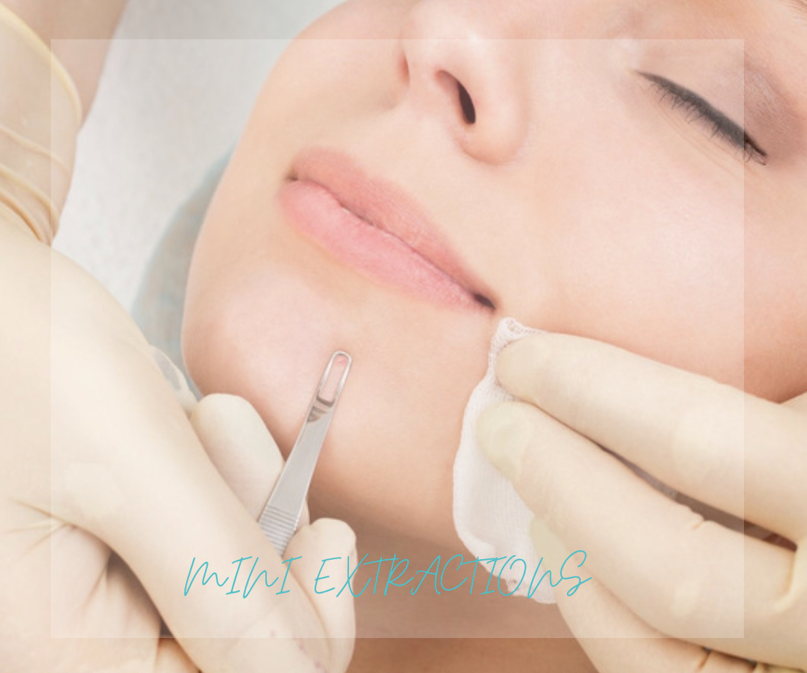 Mini facial (Extractions Only)