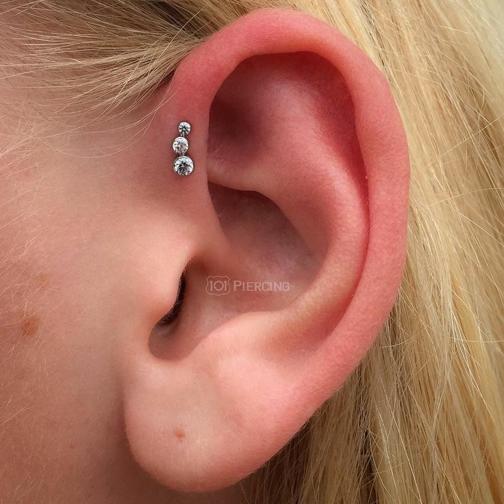 Forward Helix