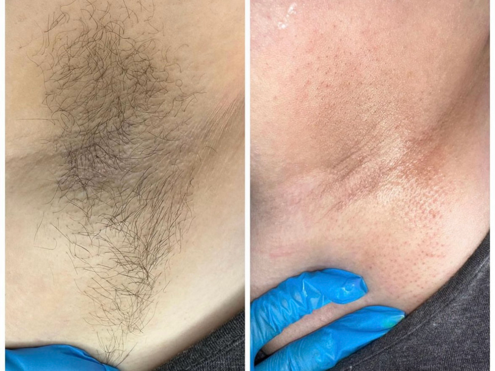 Underarm Wax ($25)