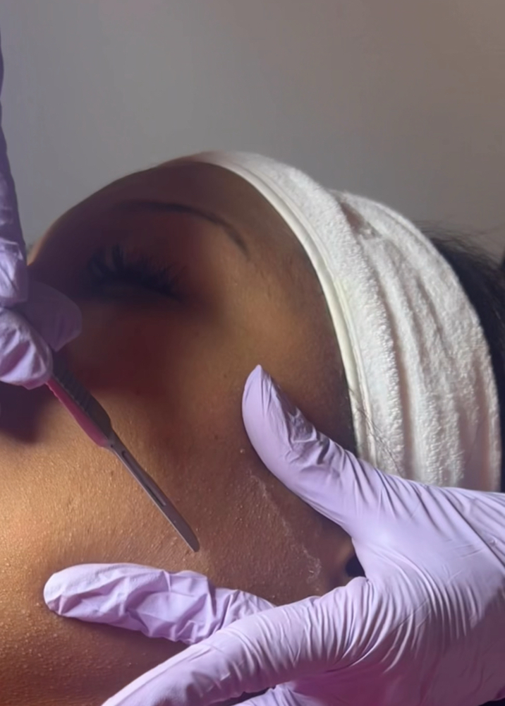 Dermaplane