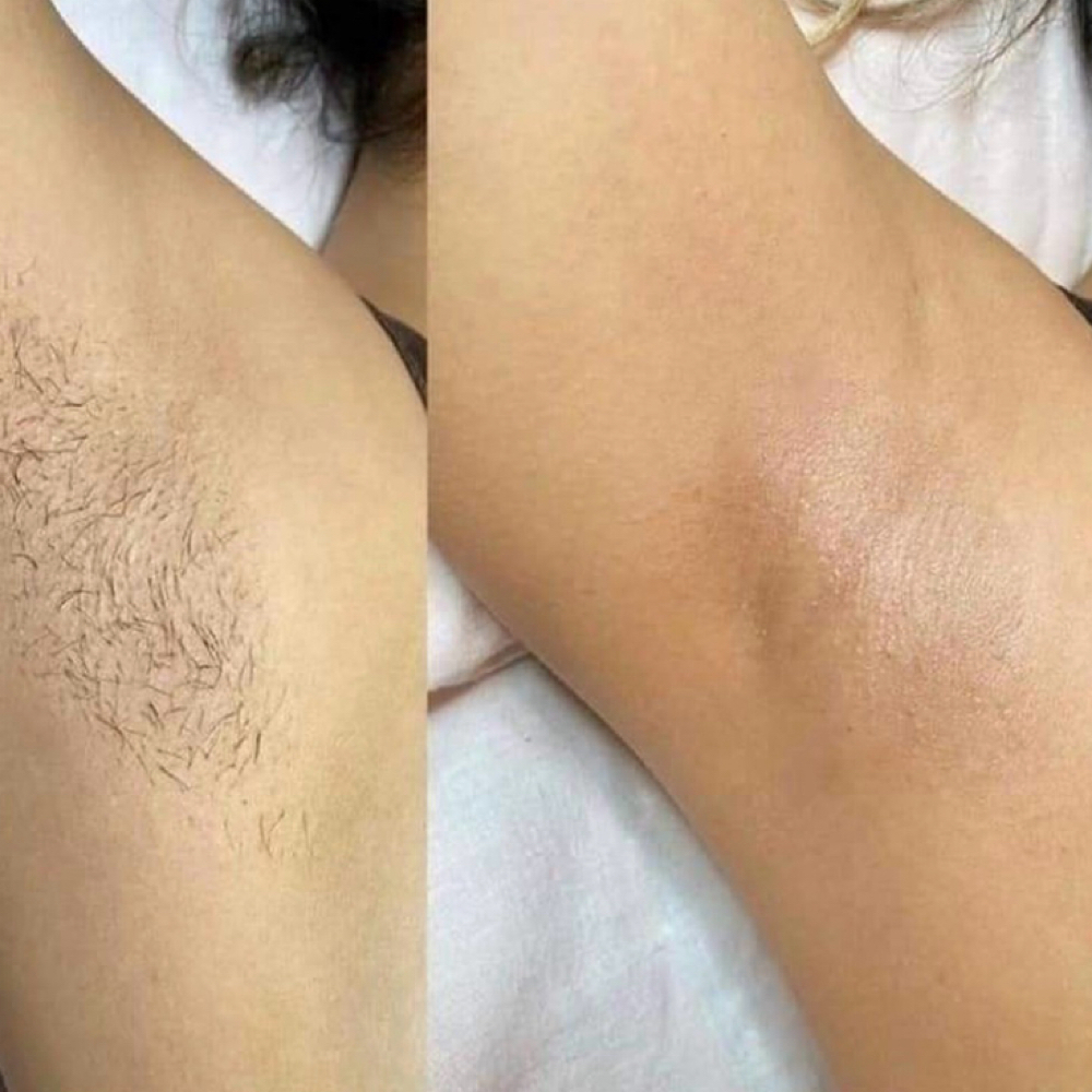 Underarm Wax- Depilacion De Axilas at Lineage Beauty Studio by Vale in Four Oaks, NC