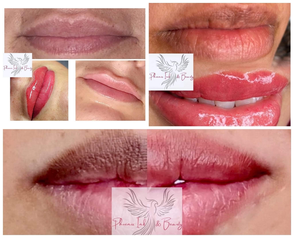 DARK LIP NEUTRALIZATION/CORRECTION