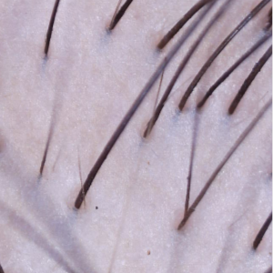 Hair & Scalp Assessment at Tri-City Hair Care in Richland, WA