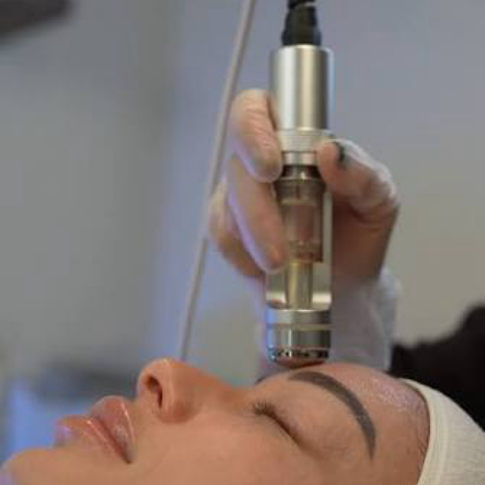 Mesotherapy Therapy at Sculpting Beauty by Pam LLC in Atascocita, TX