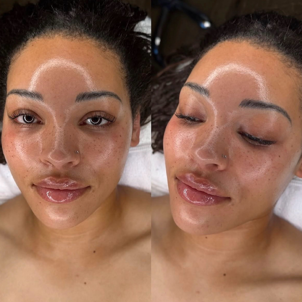 HYDRAFACIAL® at NAKED FACIALS in The Colony, TX