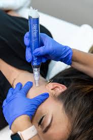 Micro Needling / Neck/Throat