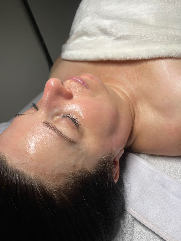 Microdermabrasion Facial