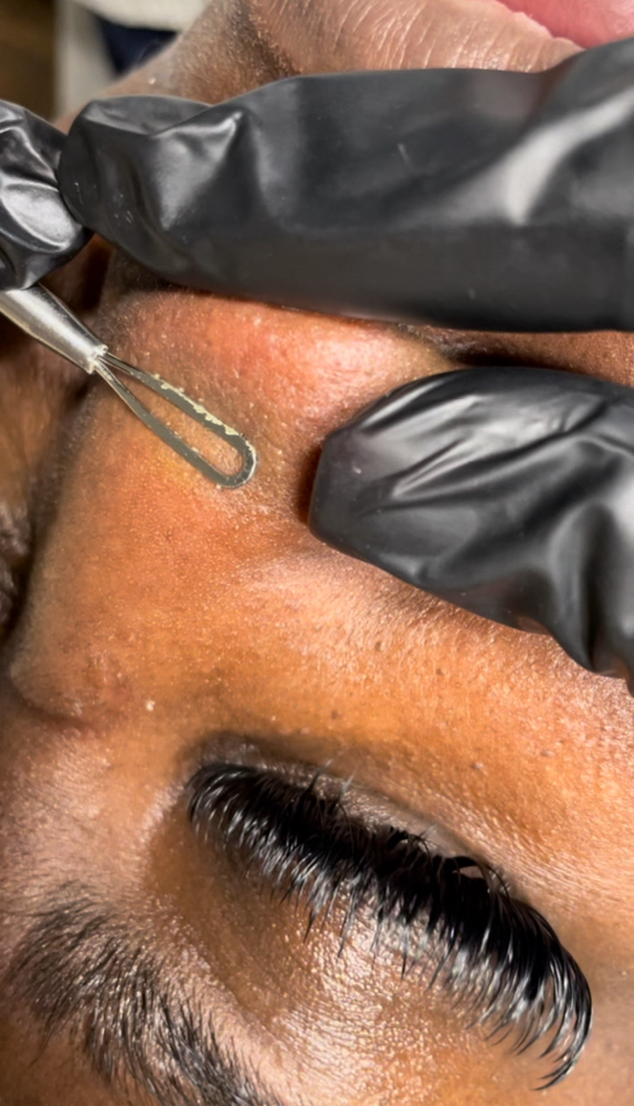 Organic Oil Removal