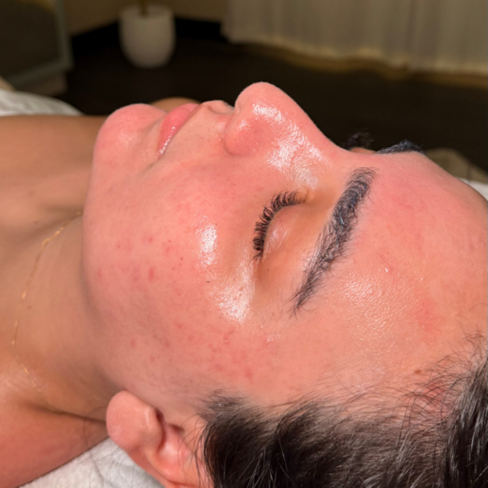Signature Glow Facial + Dermaplanin at HABIBIESTHETICS in ROCKLIN, CA