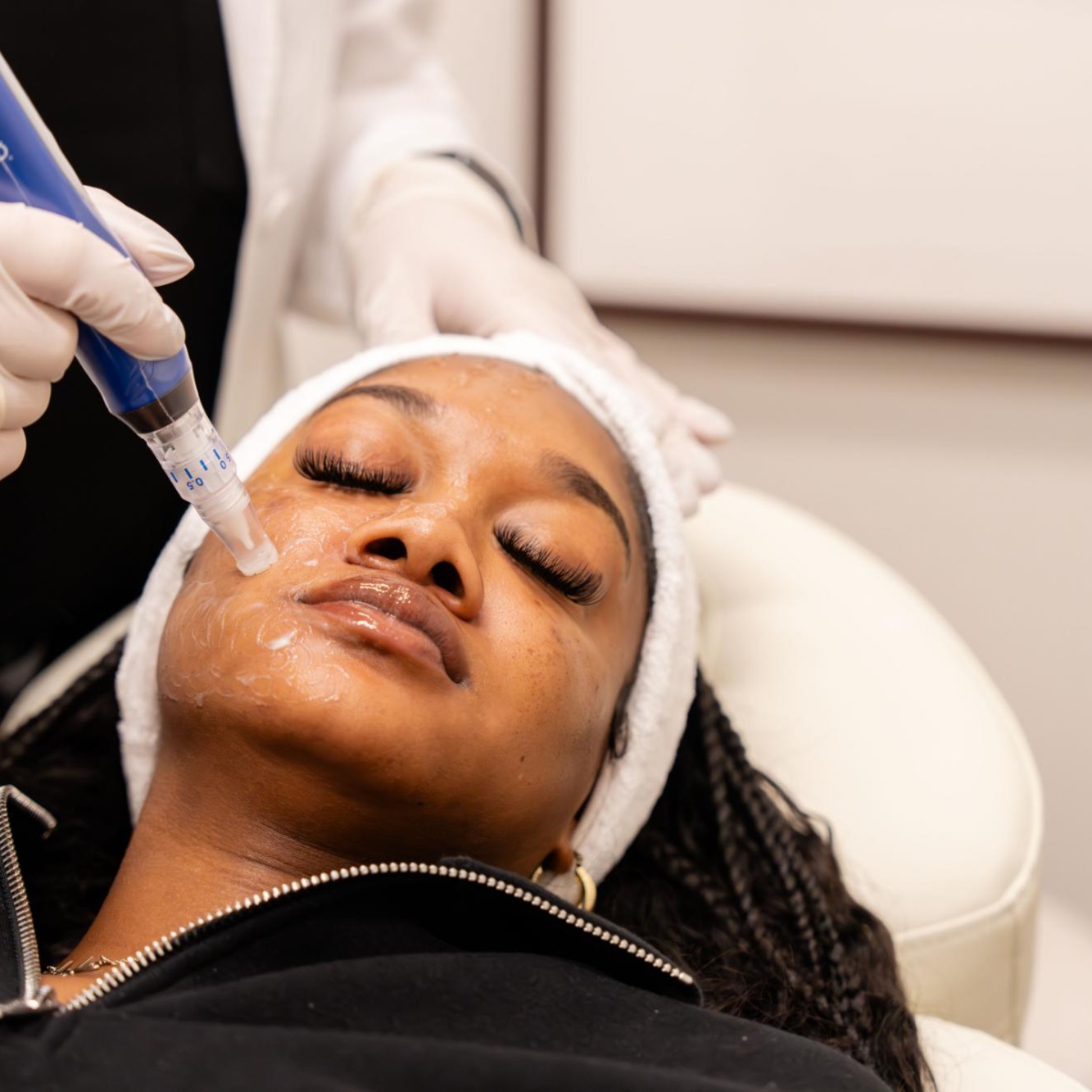 Microneedling at Ju Esthetics LLC in Goose Creek, SC