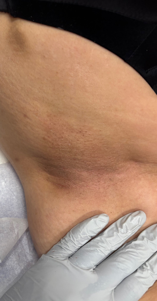 Boujee Underarm (Wax)