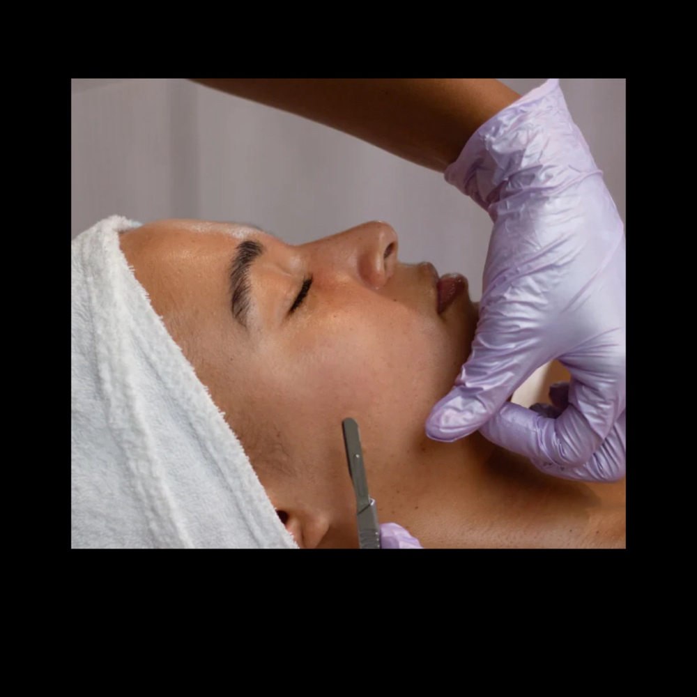 Dermaplane Facial