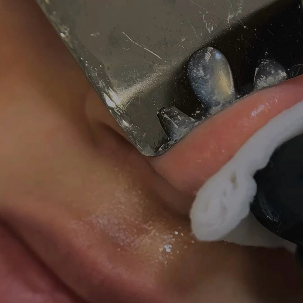 Extractions (add-on)