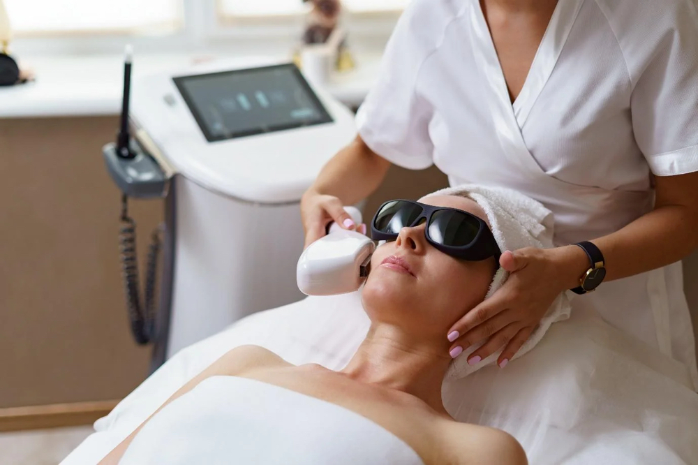 IPL Facial