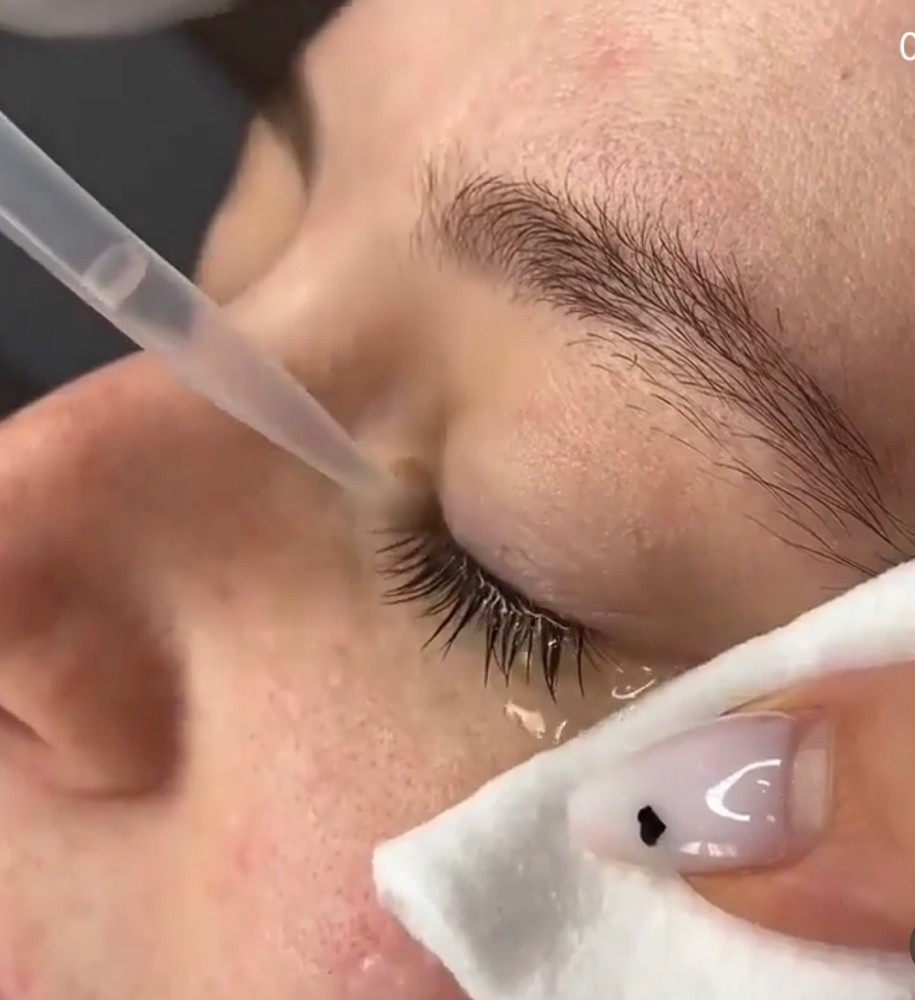 Lash Removal