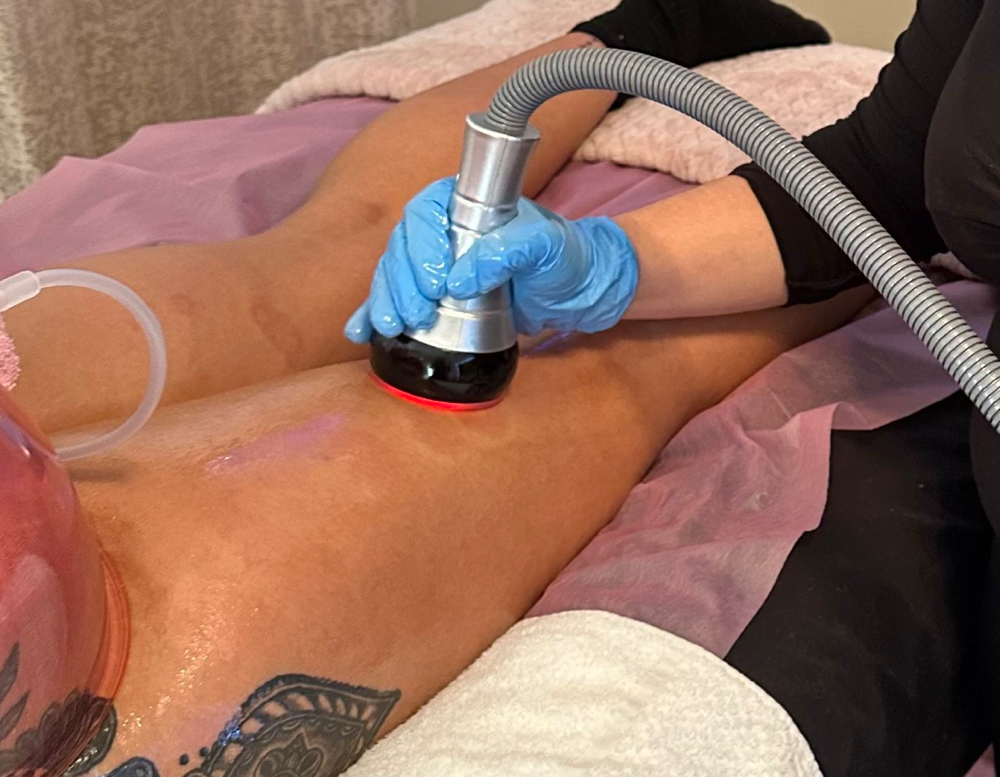 Vacuum Cellulite Therapy at TNT Sculpting in Durant, OK