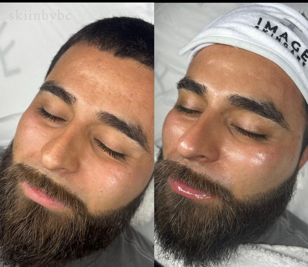 Gentlemen facial