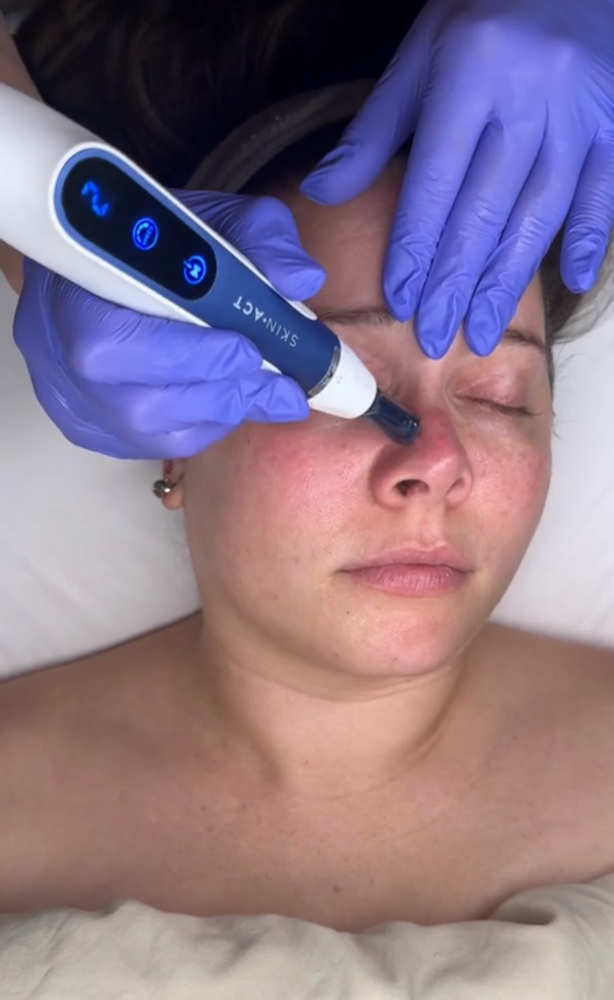Nano Infusion