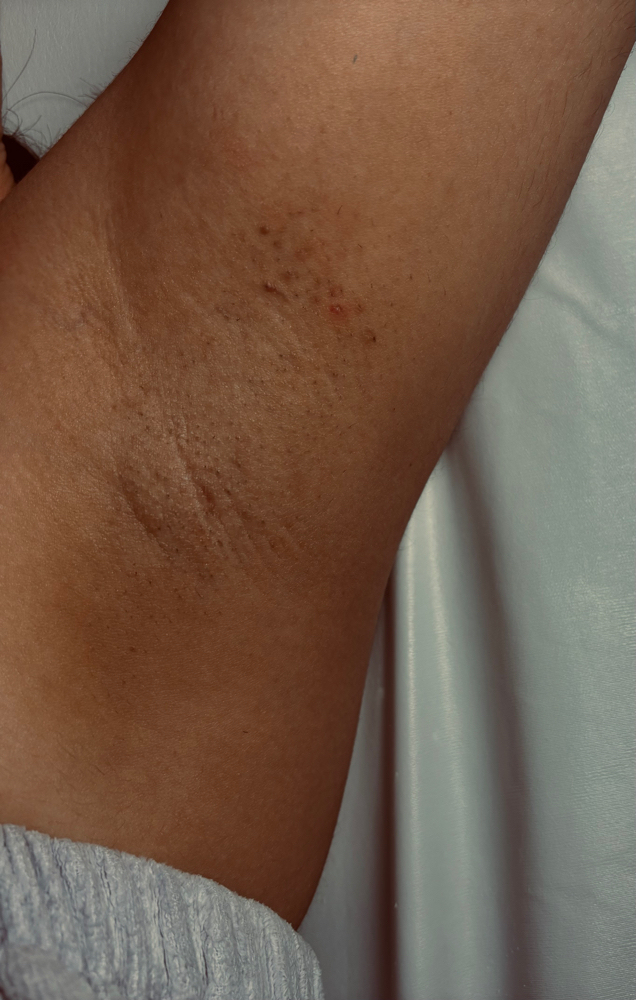 Armpit Wax at Reign Esthetics in Okmulgee, OK