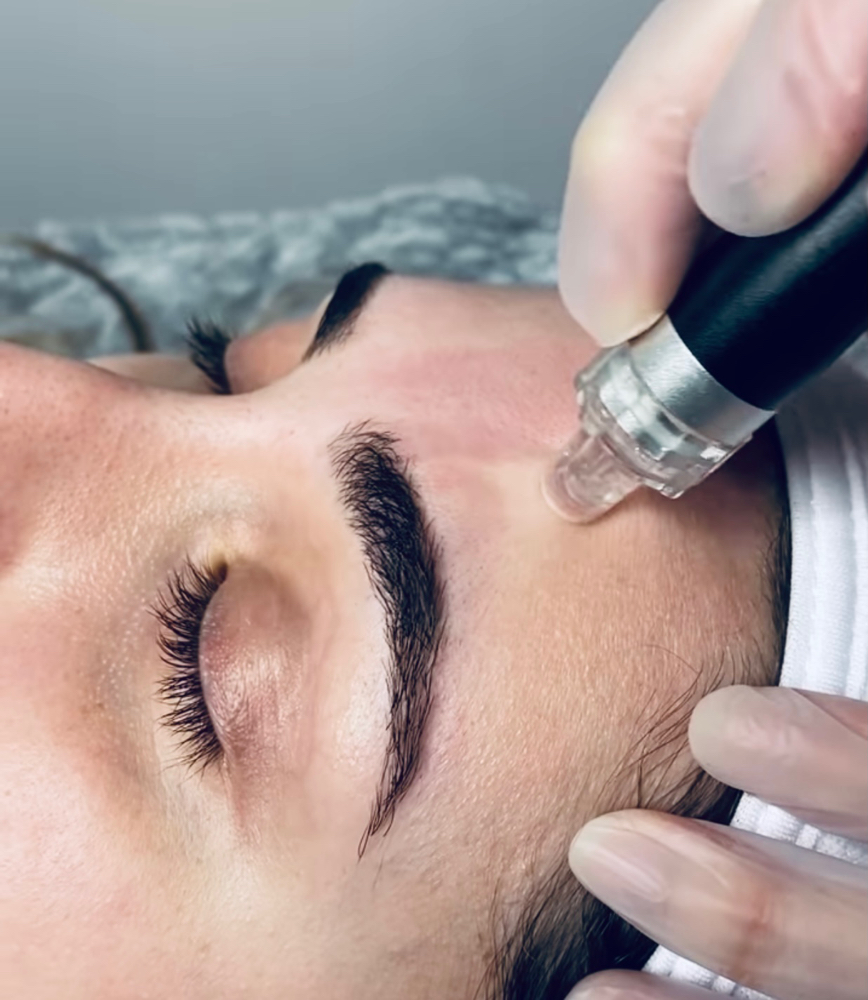 Hydrofacial Treatment