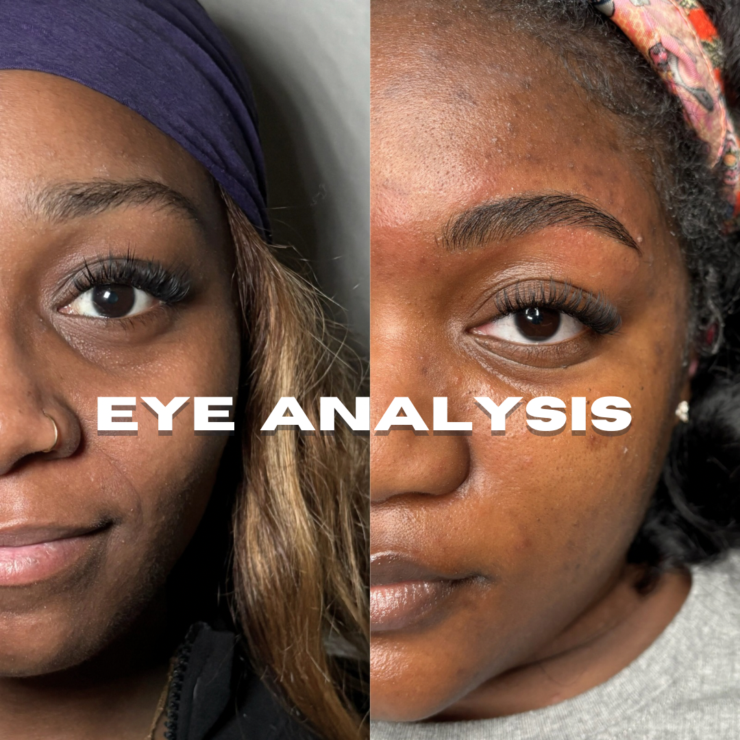 Eye Analysis Consultation