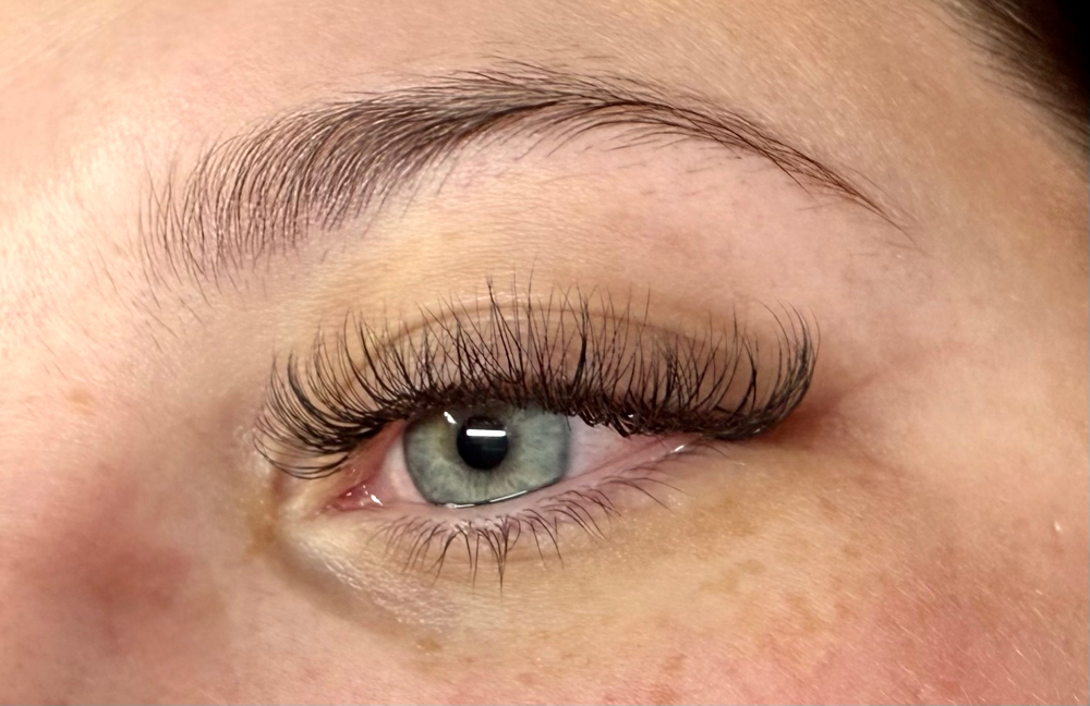 Volume Fill - 1 Week