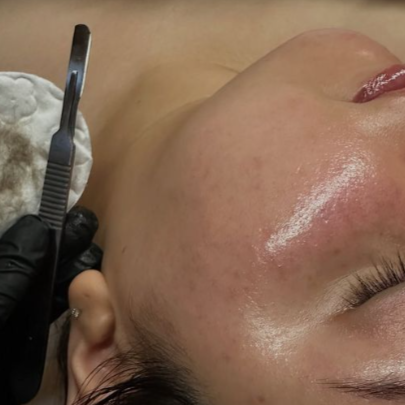 Instant Bright Dermaplane at Dew Drop Skin Lounge in Mesa, AZ