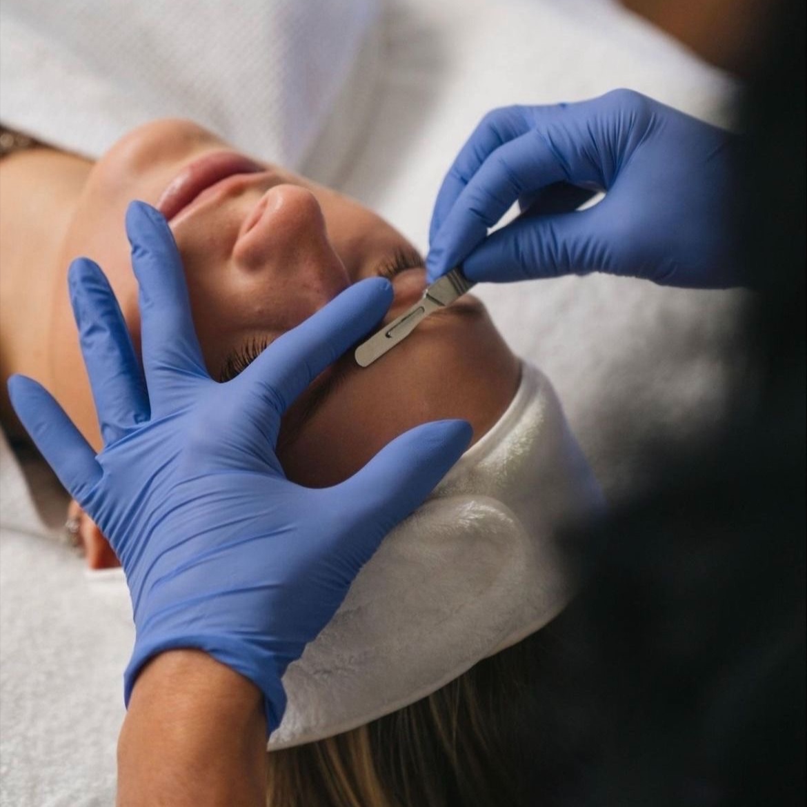 Dermaplane 45min Facial at Bare Beauty Essence in Lexington, OH