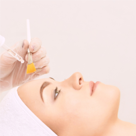 TCA Peel at Ultimate Solutions Medical Spa in Stamford, CT