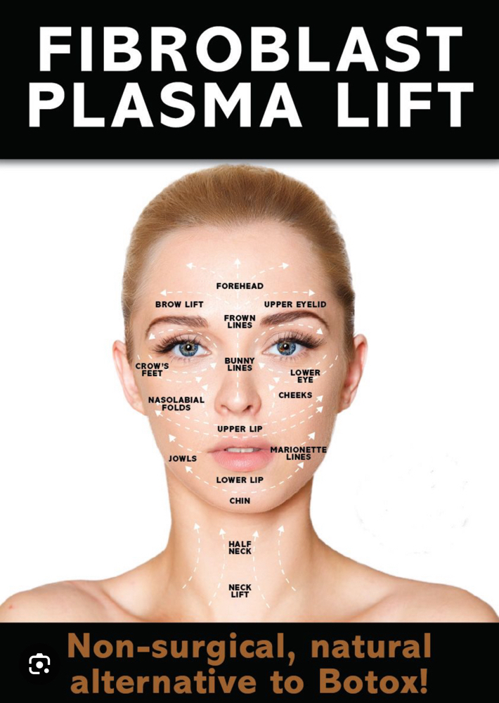 Fibroblast Skin Tightening
